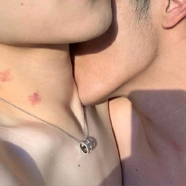 Hickey là gì? Cách tạo hickey kiss trên cơ thể người ấy
