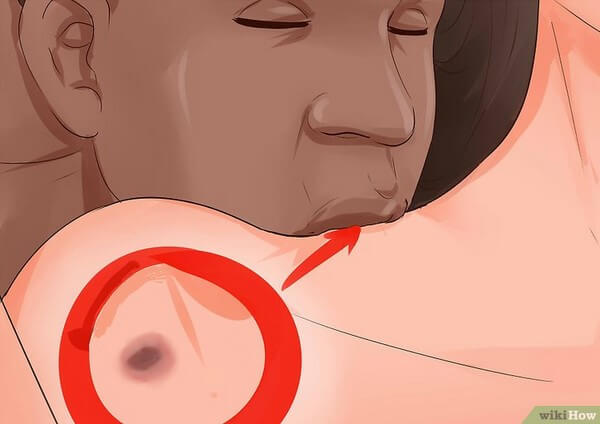 Hickey là gì? Cách để lại dấu ấn bằng Hickey sướng nhất
