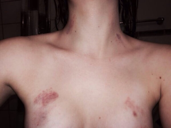 Kỹ Thuật Hickey Khiến Nàng Đê Mê Mà Không Gây Hại